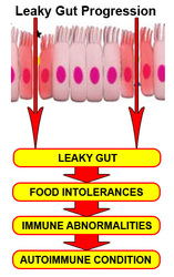 Most Comprehensive Natural Health Guide On The Market- Leaky Gut Cure