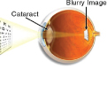 Eye Exams and Discount Contact Lenses | EssexEye